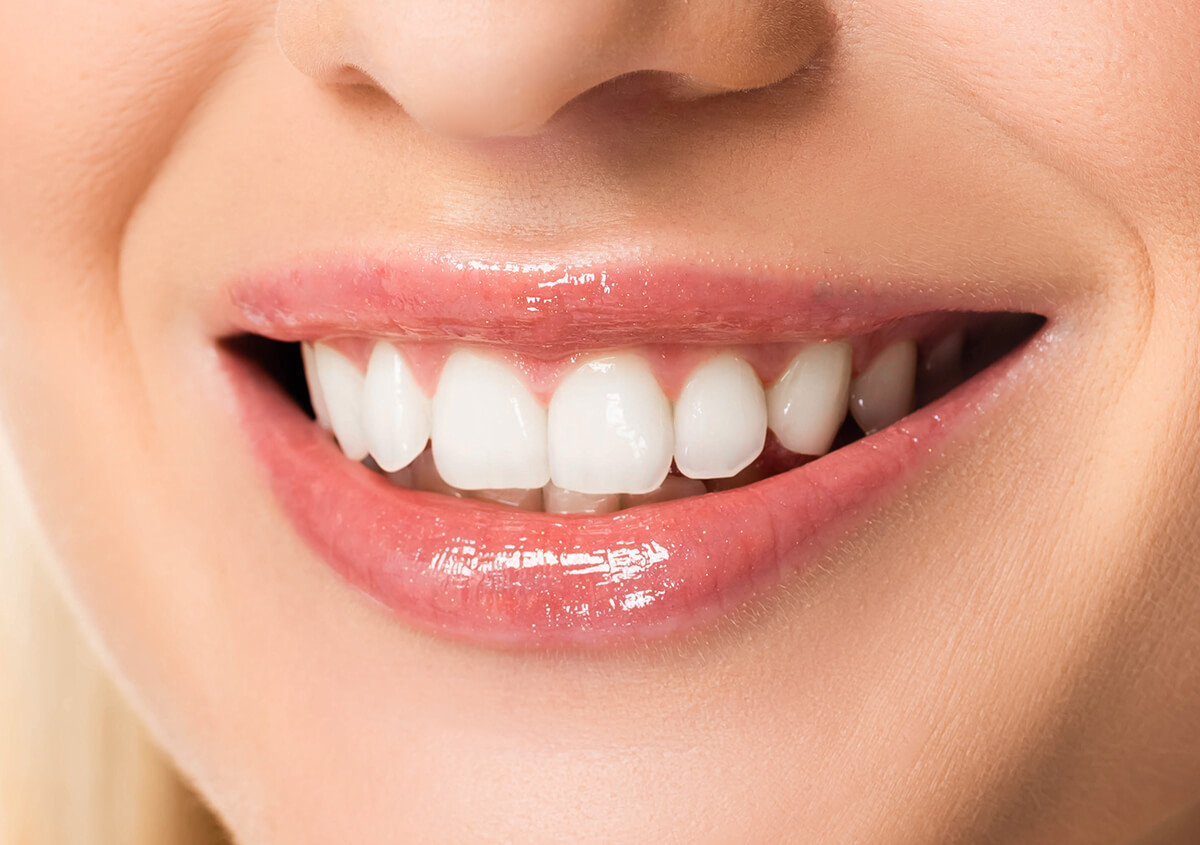 Add a sparkle to your smile with Professional Teeth Whitening