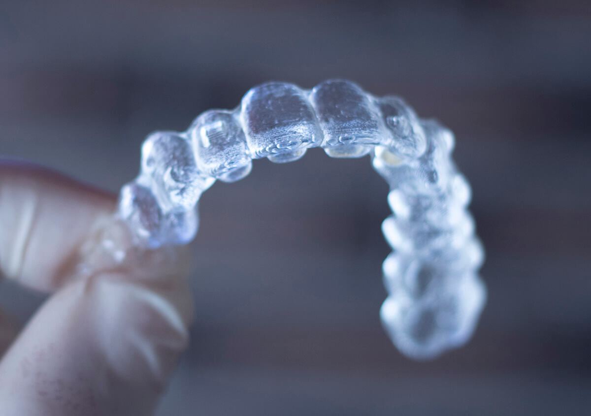 How Long Does It Take to Get Your SureSmile Aligners in Frederick MD Area